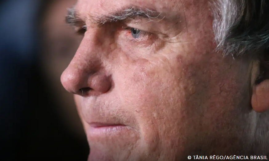 Com crise persistente de soluços, Bolsonaro faz nova cirurgia